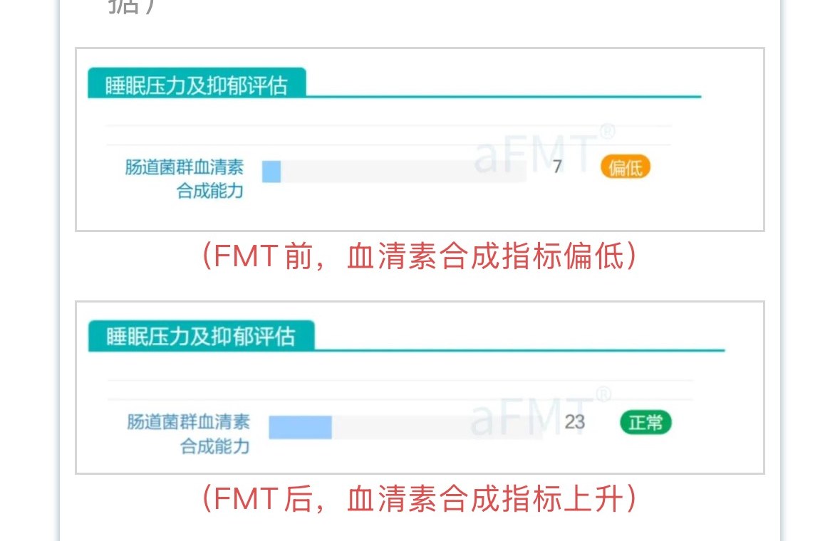 案例一 FMT 前后血清素合成能力对比(FMT 前 偏低 7,FMT 后 正常 23)